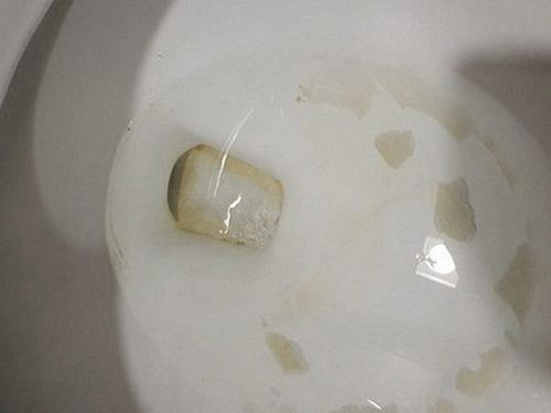창동 하수구막힘 아파트에서 왜 자주 생길까